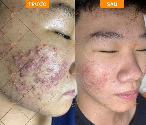 Đưa thông tin về doanh nghiệp của bạn lên Top247.vn.